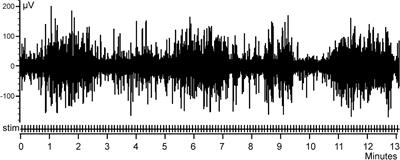 Assessment of a single trial impact on the amplitude of the averaged event related potentials